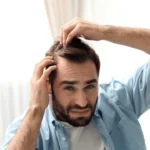 Hair loss