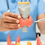 Hypo and Hyperthyroidism