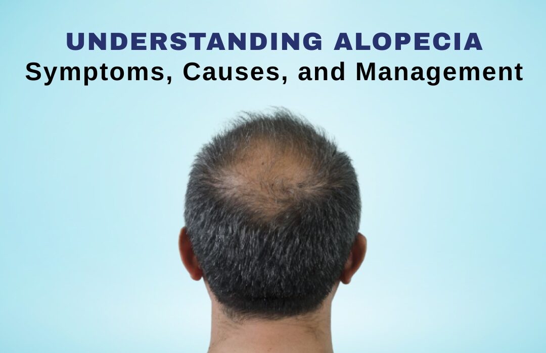 Understanding Alopecia: Symptoms, Causes & Homeopathy Treatment in Abu Dhabi
