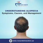 Understanding Alopecia: Symptoms, Causes & Homeopathy Treatment in Abu Dhabi