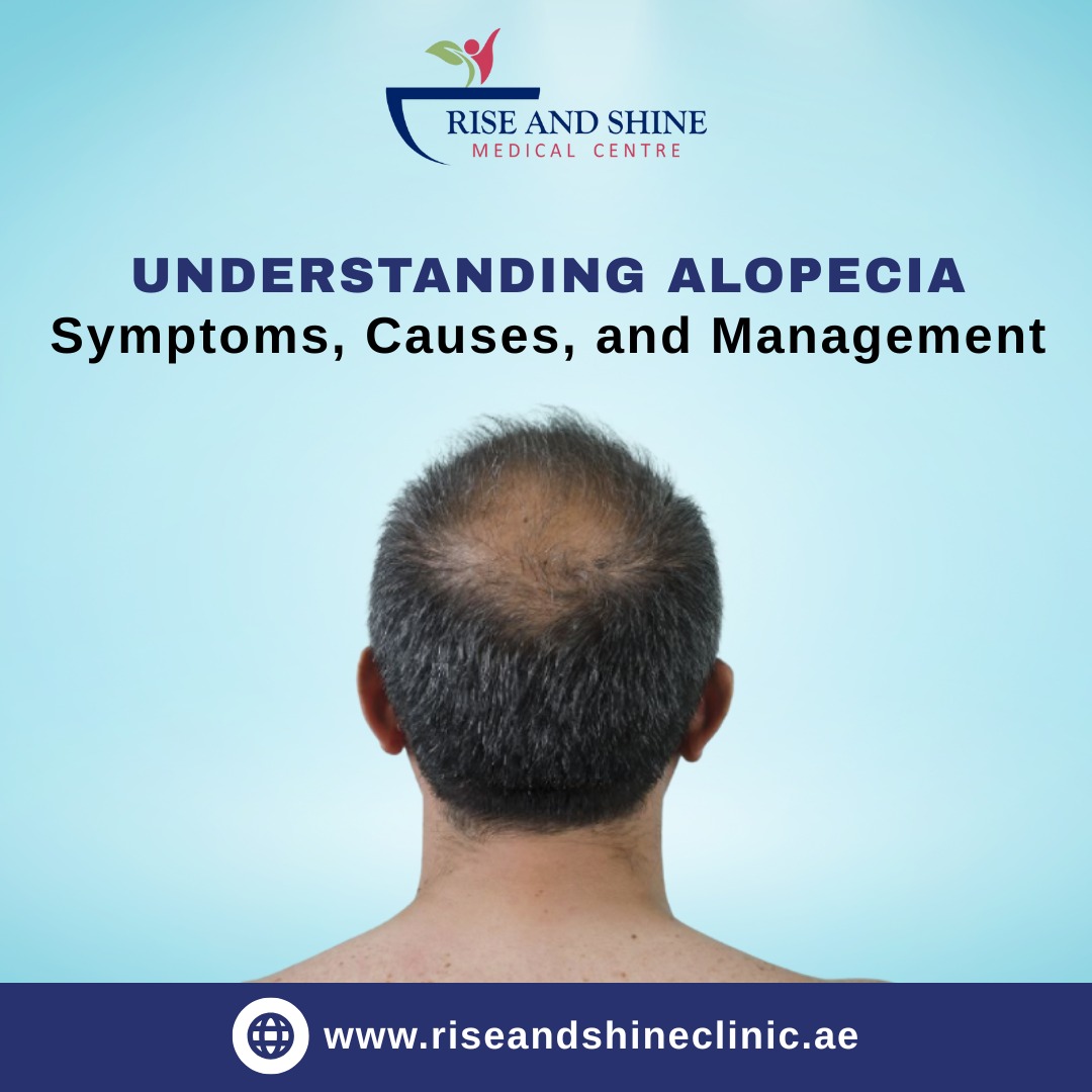 Understanding Alopecia: Symptoms, Causes & Homeopathy Treatment in Abu Dhabi
