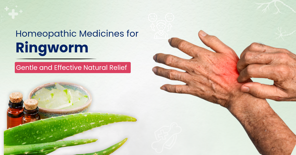 Homeopathic Medicin for Ringworm